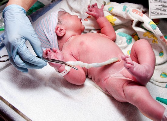  As with many other decisions expectant parents make, there is no right or wrong choice when it comes to cord blood banking.