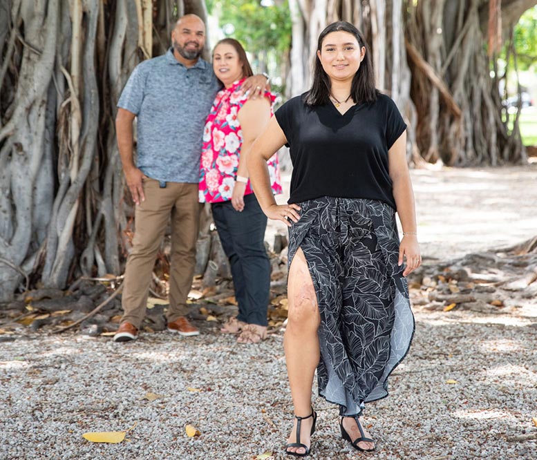 Young woman in foreground showing burn scarred leg with her parents in the background.