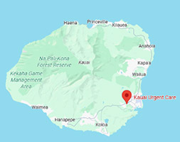 Map of Kauai showing urgent care location in Lihue.