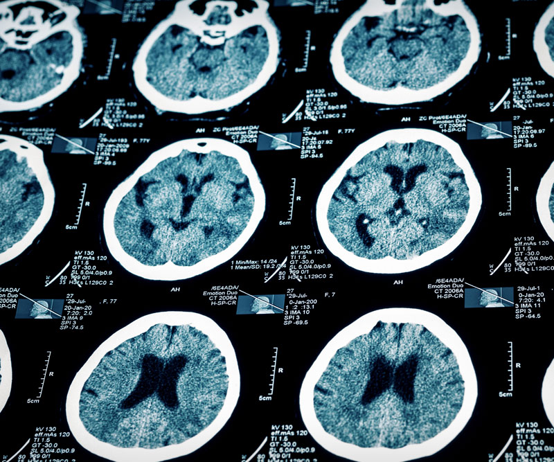 numerous brain scans