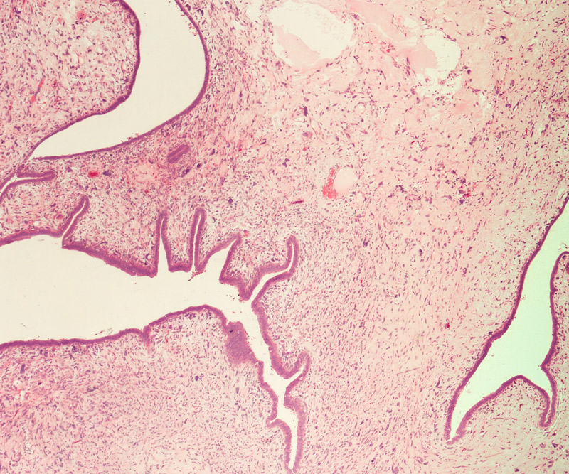 doctor examining an xray scan of a breast